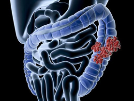 Intestine